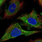 Immunofluorescent staining of human cell line SiHa shows localization to intermediate filaments.