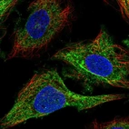 Immunofluorescent staining of human cell line SiHa shows localization to intermediate filaments.