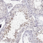 Immunohistochemical staining of human testis shows moderate cytoplasmic positivity in spermatids.