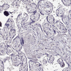 Immunohistochemical staining of human placenta shows no positivity in trophoblastic cells as expected.