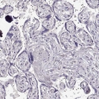 Immunohistochemical staining of human placenta shows no positivity in trophoblastic cells as expected.