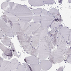 Immunohistochemical staining of human skeletal muscle shows no positivity in myocytes as expected.