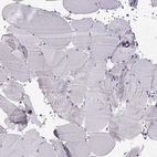 Immunohistochemical staining of human skeletal muscle shows no positivity in myocytes as expected.