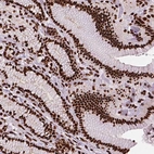 Anti-SMIM5 Antibody