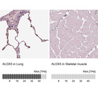 Anti-ALOX5 Antibody