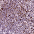 Immunohistochemical staining of human tonsil shows strong positivity in nuclear membrane in non-germinal center cells.