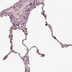 Immunohistochemical staining of human lung shows strong nuclear positivity in macrophages.