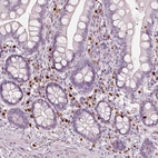 Immunohistochemical staining of human small intestine shows strong nuclear positivity in lymphoid cells.