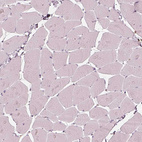 Immunohistochemical staining of human skeletal muscle shows no positivity in myocytes as expected.