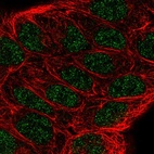 Immunofluorescent staining of human cell line RT4 shows localization to nucleoplasm.