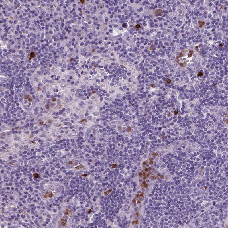 Anti-NTNG2 Antibody