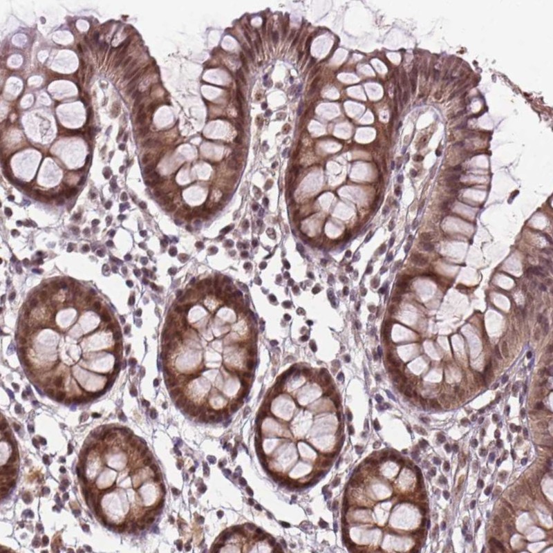Anti-ANKRD54 Antibody