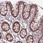 Anti-ANKRD54 Antibody