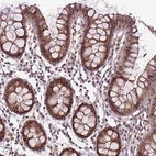 Anti-ANKRD54 Antibody