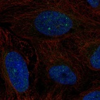 Anti-ERCC6 Antibody