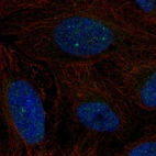 Anti-ERCC6 Antibody