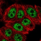 Anti-RCL1 Antibody