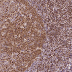 Anti-SMC2 Antibody