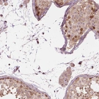 Immunohistochemical staining of human testis shows strong nuclear/nucleoli positivity in cells in seminiferous ducts and Leydig cells with additional cytoplasmic positivity.