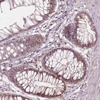 Immunohistochemical staining of human rectum shows moderate positivity in nucleoli/cytoplasmic in glandular cells.