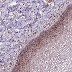 Immunohistochemical staining of human cervix, uterine shows strong positivity in nucleoli in squamous epithelial cells.
