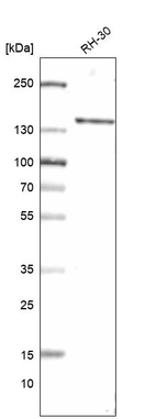 Western blot analysis in human cell line RH-30.