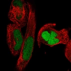 Immunofluorescent staining of human cell line RH-30 shows localization to nucleus.