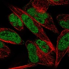 Anti-THAP1 Antibody