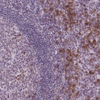 Anti-TMEM184A Antibody
