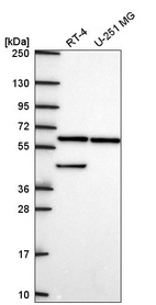 Anti-KLHL12 Antibody