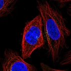 Immunofluorescent staining of human cell line SiHa shows localization to microtubule organizing center & vesicles.