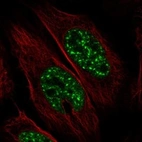 Anti-SCAND1 Antibody