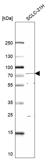 Anti-E4F1 Antibody