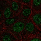Immunofluorescent staining of human cell line MCF7 shows localization to nucleoplasm.