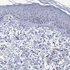 Immunohistochemical staining of human skin shows low expression as expected.