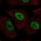 Anti-TLE1 Antibody