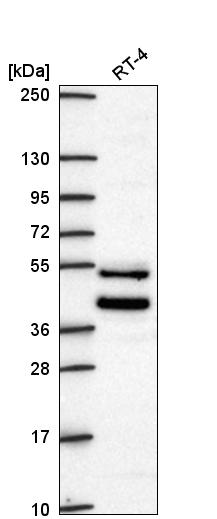 Anti-ZNF621 Antibody