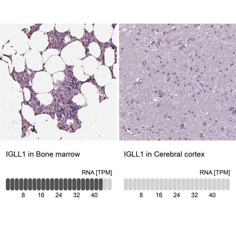 Anti-IGLL1 Antibody