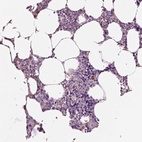 Immunohistochemical staining of human bone marrow shows high expression.