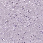 Immunohistochemical staining of human cerebral cortex shows low expression as expected.