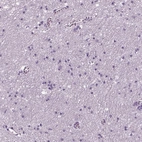 Immunohistochemical staining of human cerebral cortex shows low expression as expected.