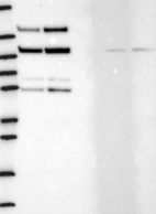 Lane 1: Marker [kDa] 250, 130, 95, 72, 55, 36, 28, 17, 10 | Lane 2: RT4 | Lane 3: U-251 MG | Lane 4: Human Plasma | Lane 5: Liver | Lane 6: Tonsil