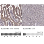 Anti-SLC22A18 Antibody