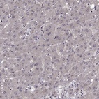 Anti-SLC22A18 Antibody