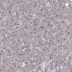 Immunohistochemical staining of human liver shows low expression as expected.