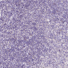 Anti-CTAG2 Antibody