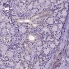 Immunohistochemical staining of human salivary gland shows moderate nuclear positivity in a subset of glandular cells.