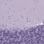 Immunohistochemical staining of human cerebellum shows no positivity in Purkinje cells as expected.