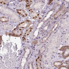Immunohistochemical staining of human kidney shows moderate nuclear positivity in a subset of cells in tubules.
