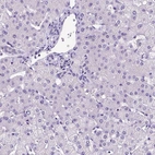 Immunohistochemical staining of human liver shows no positivity in hepatocytes as expected.